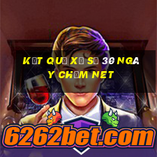 kết quả xổ số 30 ngày chấm net